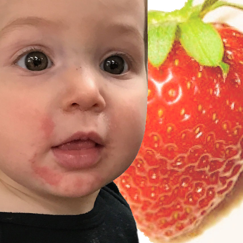 How to know if baby is allergic to strawberries